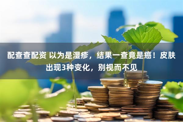 配查查配资 以为是湿疹，结果一查竟是癌！皮肤出现3种变化，别视而不见